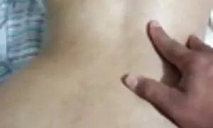 Wɔ anal prolapse ɔye ...