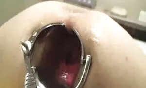 Anal, akɛse ne atiri ...